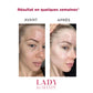 SKINLIFT : Masseur lifting peau anti-âge et anti-acné